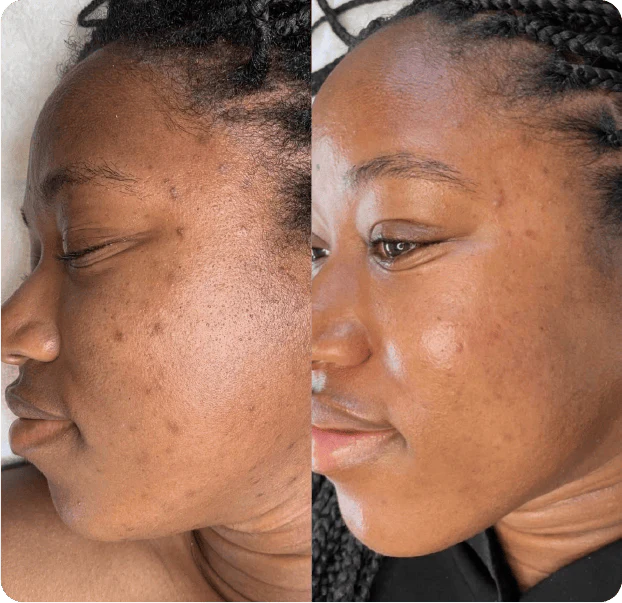 Medicube Glass Glow Skincare Set (8 pcs)™