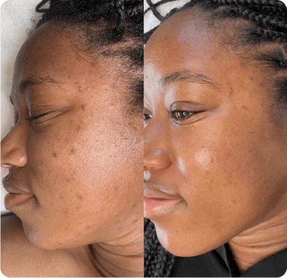 Medicube Glass Glow Skincare Set (8 pcs)™